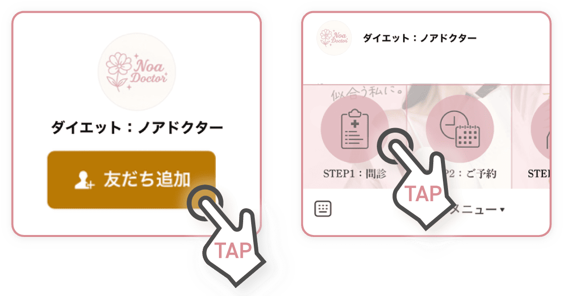 リッチメニューのSTEP1：STEP1:問診